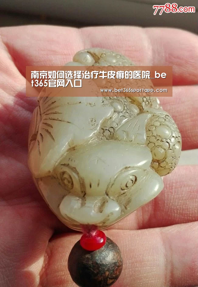 南京如何选择治疗牛皮癣的医院_bet365官网入口(图1) bet365体育官网